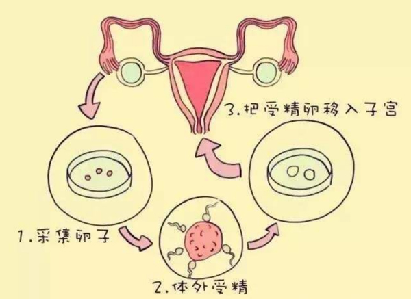 泰国试管婴儿为什么不建议移植两个胚胎？成功率高吗？